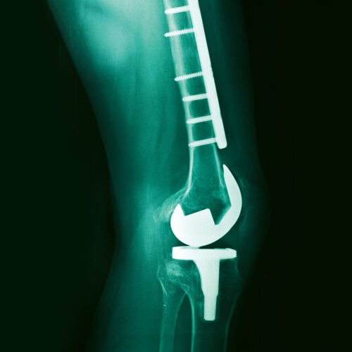 Beitragsbild für Medizintechnik (Bachelor/Master)